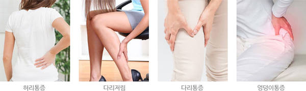 모커리한방병원 허리통증 , 다리저림 , 다리통증 , 엉덩이통증 이미지